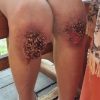 عنف منزلي مبتكر ومروع من أم وزوجها في حق طفل عمره 8 سنوات