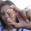 الوفيات الجنينية “مأساة مهملة” بحسب الأمم المتحدة